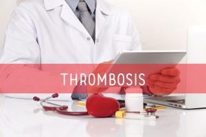 A image of a doctor ready to work on a thrombosis case.