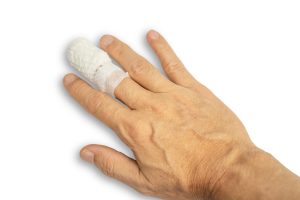 A finger injury of the middle finger. Claiming finger injury compensation for this could be important.