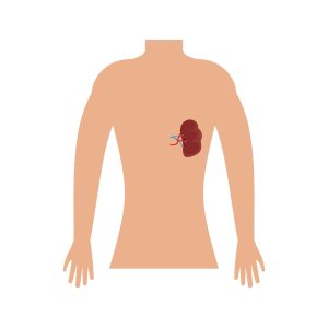 A drawing of the torso of a person with spleen injuries.