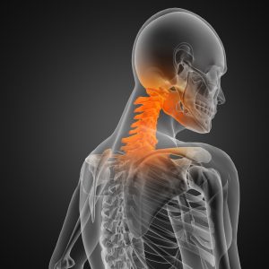 X-ray of a persons neck for making a neck injury claim