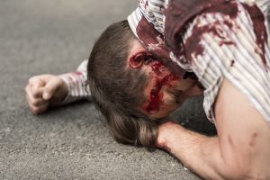 Many lying on the floor with severe head injury to make a head injury claim