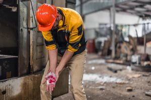 A worker has suffered a lacerated hand.